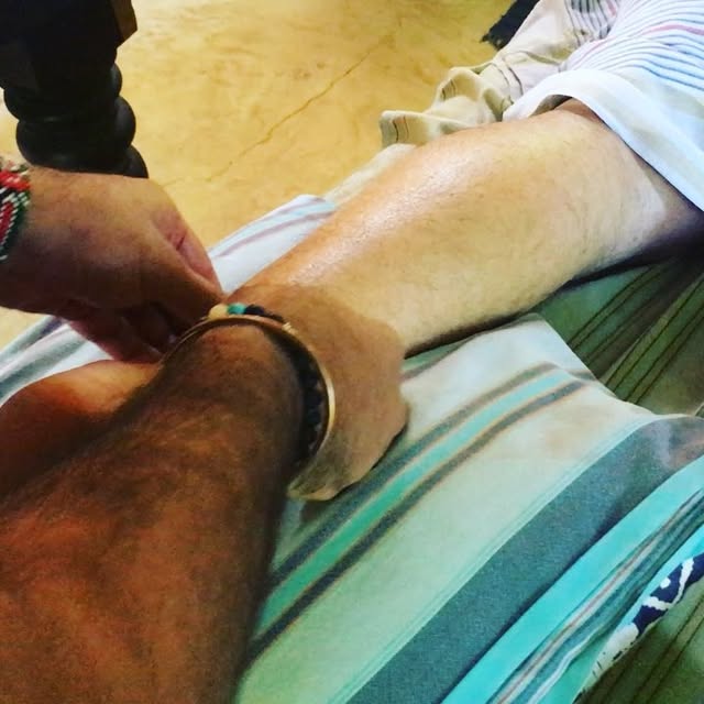 #fascia#fasciarelease#calf#achilles#achillesrupture#rehab#wow#relief #drammarhassanali #meetthephysio #drycupping #dryneedling #results #drycuppingtherapy #dryneedlingtherapy #chiropractic #painrelief • • • • • #rehab #…