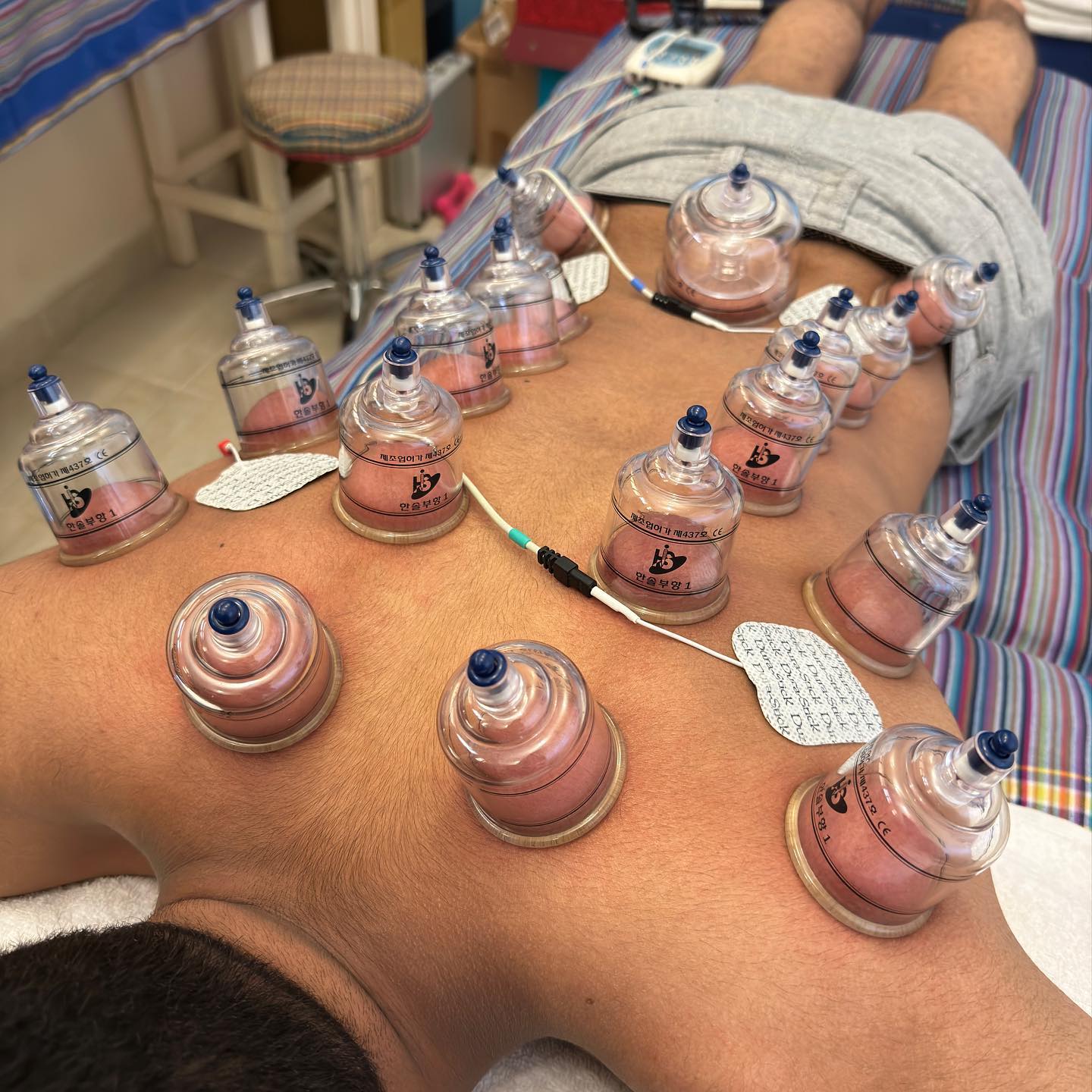 You want to recover? Struggling with pain? I promise to make you feel alive in one session. A promise to keep you moving. #cuppingmassagetherapy #cupping #recovery #trainhard #training #massage